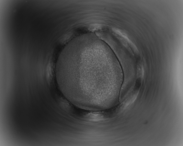 X0000087520280200705181018