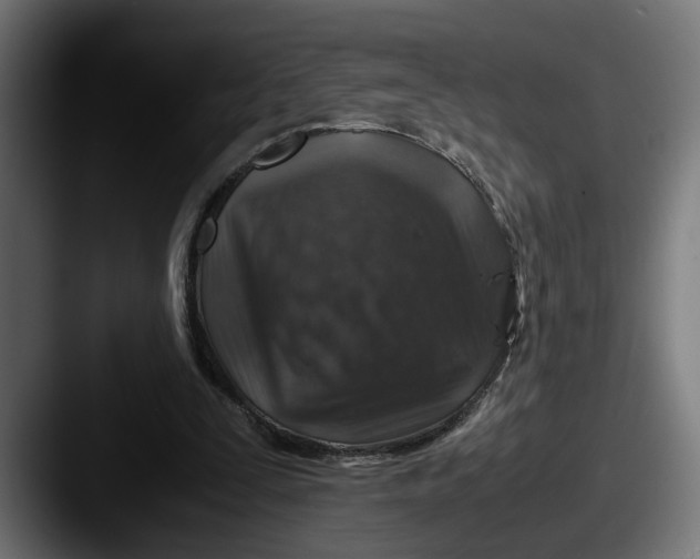 X0000087520295200705181017