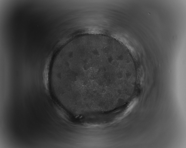 X0000087520299200705181017