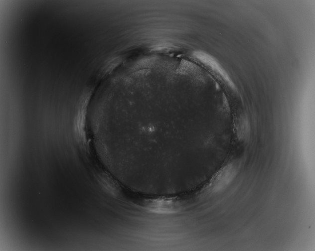 X0000087520366200705181017