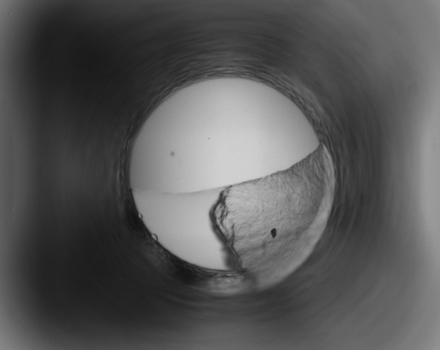 X0000087520369200705181017