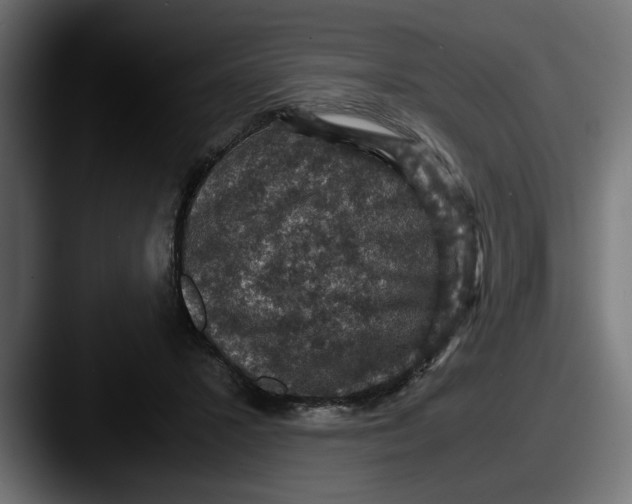 X0000087520407200705181016