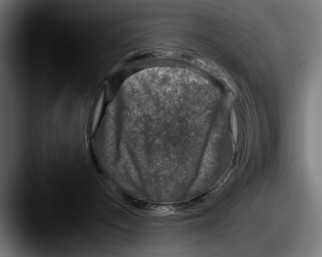 X0000087520409200705181016