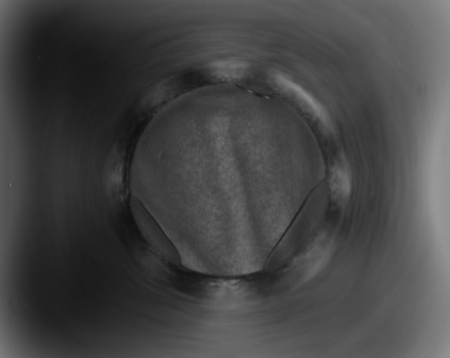 X0000087520428200705181016