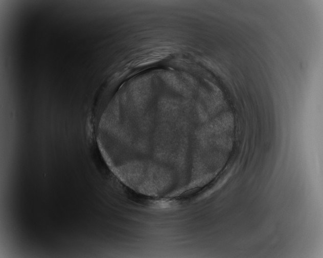 X0000087520432200705181016