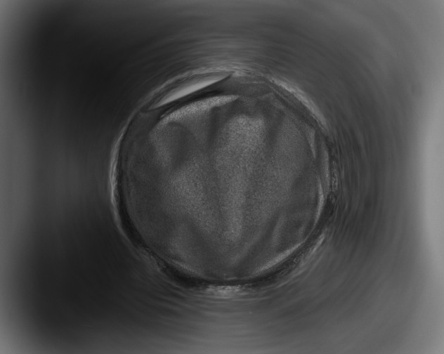 X0000087520440200705181015