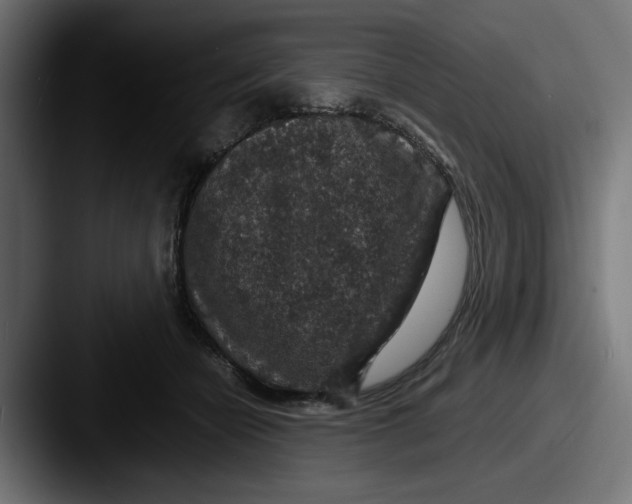 X0000087520462200705181015