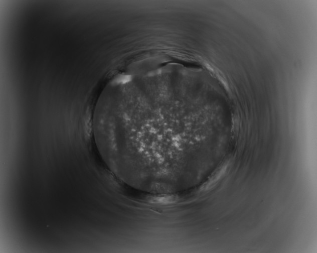 X0000087520479200705181016