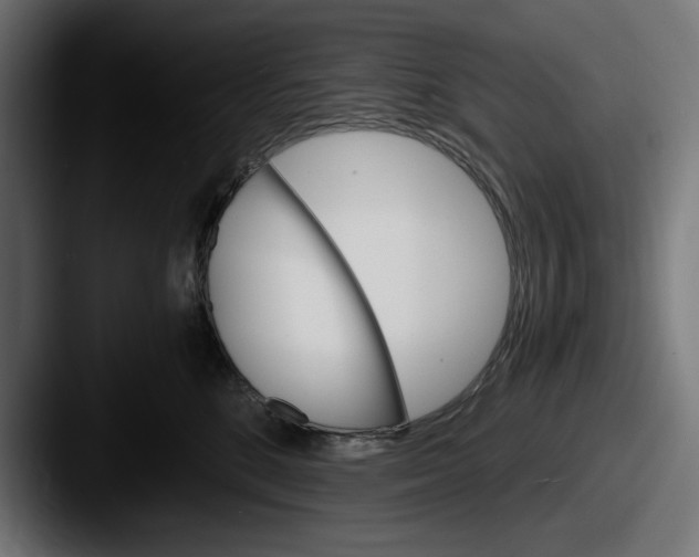 X0000087520520200705181015