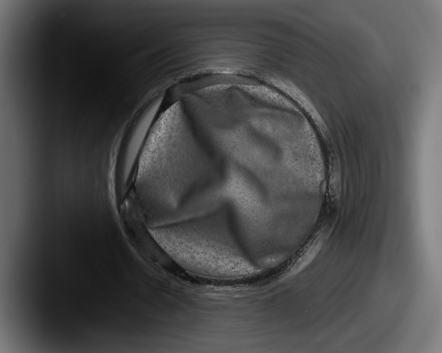 X0000087520530200705181014