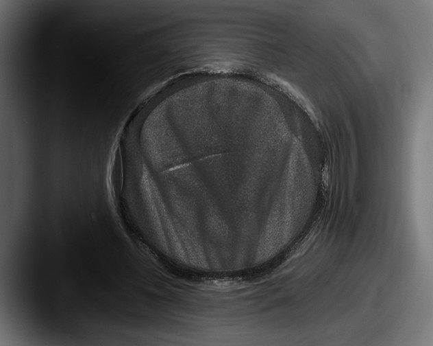 X0000087520540200705181014