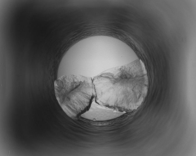 X0000087520557200705181014