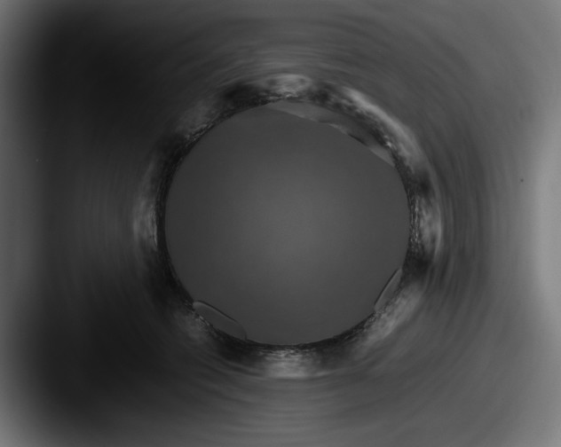 X0000087520562200705181014