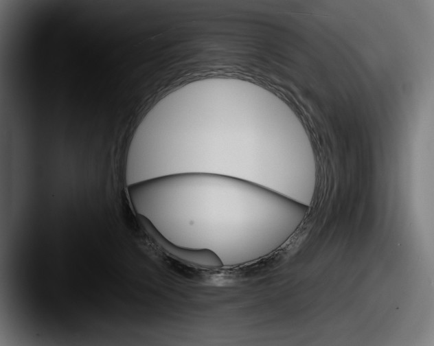 X0000087520564200705181014