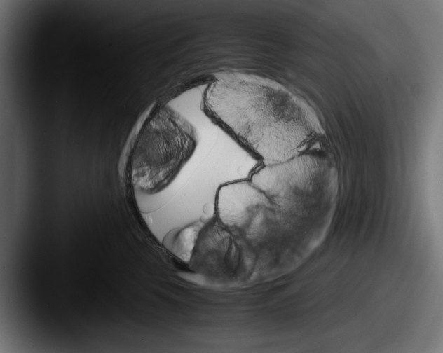 X0000087520569200705181014