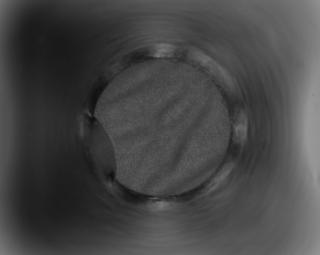 X0000087520620200705181013