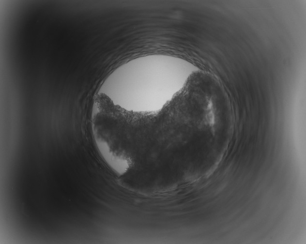 X0000087520663200705181013