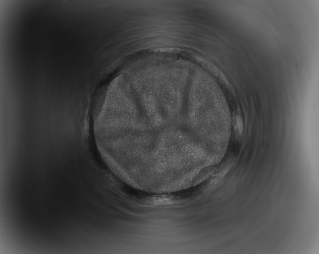 X0000087520668200705181013