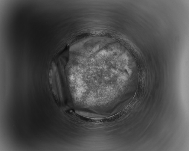 X0000087520696200705181013