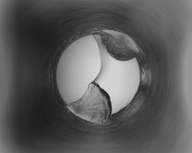 X0000087520819200705181011