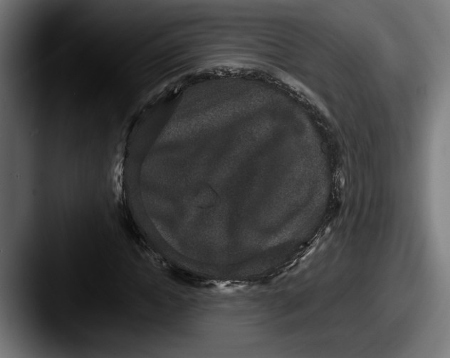 X0000087520822200705181011