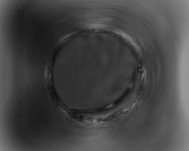 X0000087520872200705181011