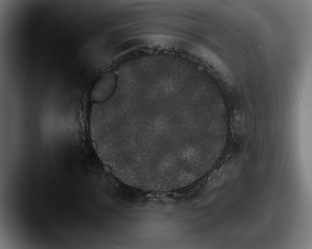 X0000087520918200705181010