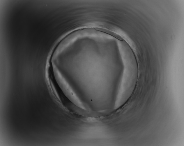 X0000087520960200705181010