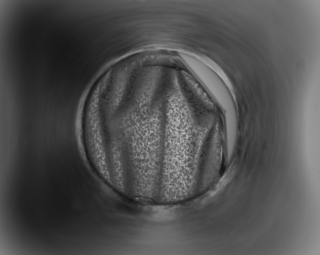 X0000087521005200705181009