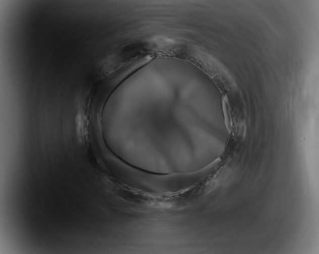 X0000087521010200705181008