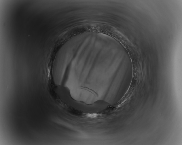 X0000087521013200705181008