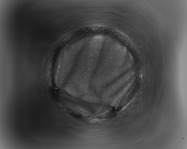 X0000087521014200705181008