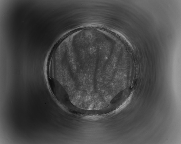 X0000087521038200705181009