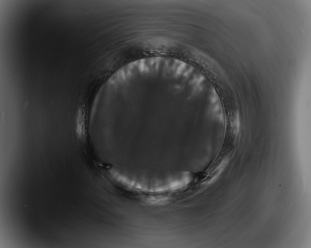 X0000087521060200705181008