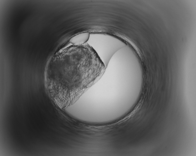 X0000087521075200705181008