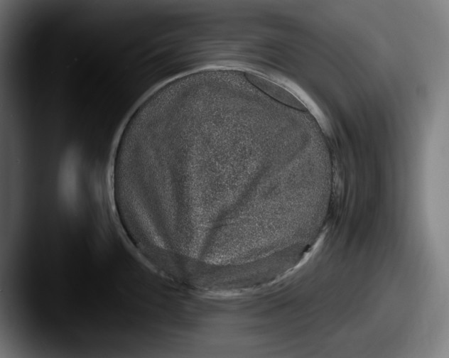 X0000087521100200705181008