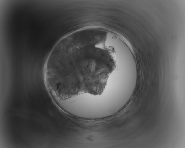 X0000087521103200705181008