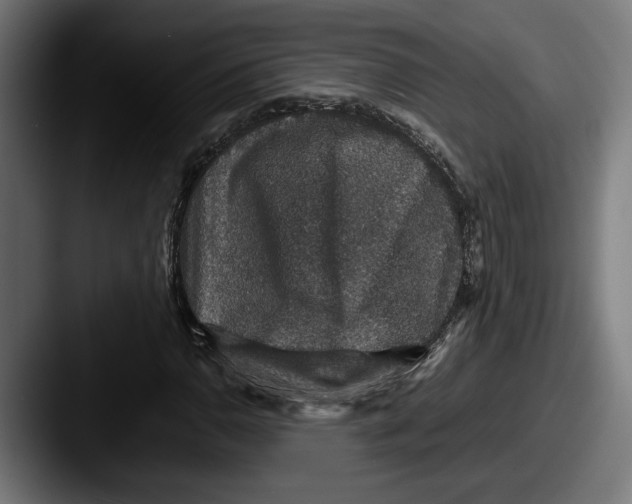 X0000087521110200705181007