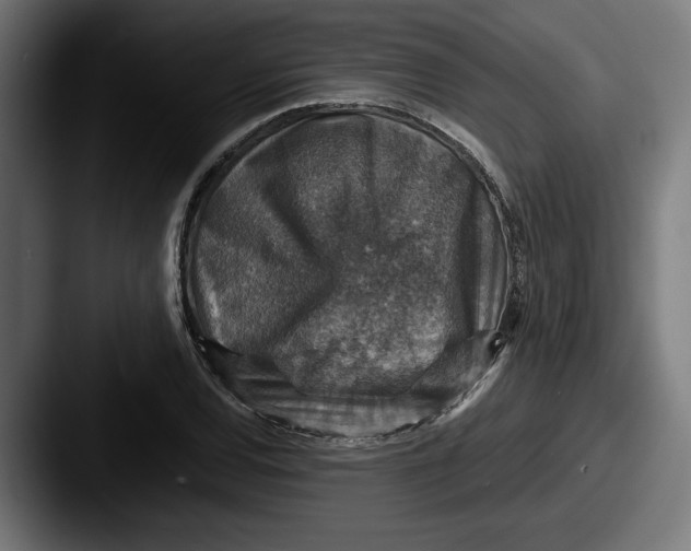 X0000087521120200705181007