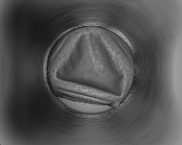 X0000087521140200705181008