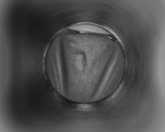 X0000087521145200705181008