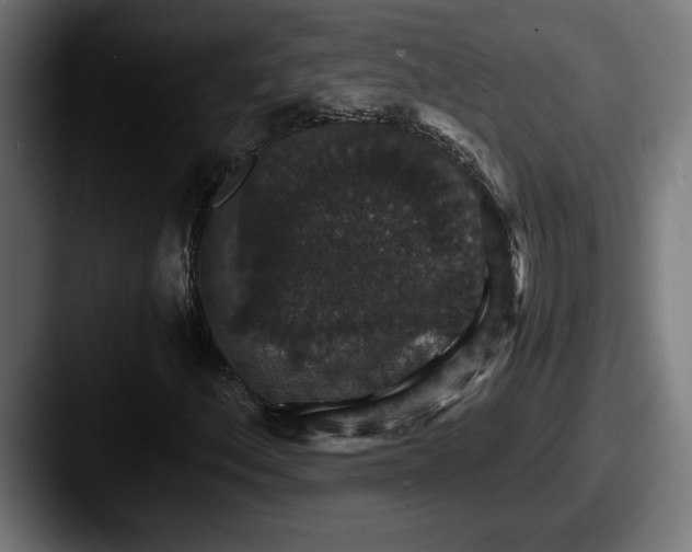 X0000087521156200705181007