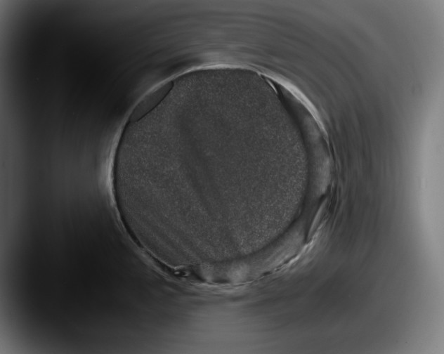 X0000087521197200705181007