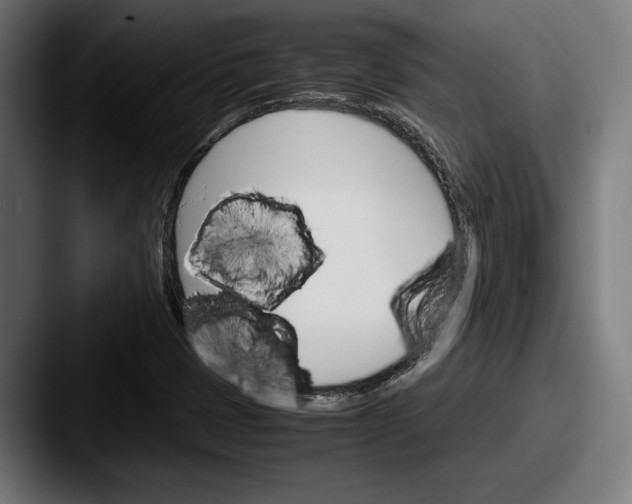 X0000087521401200705181004