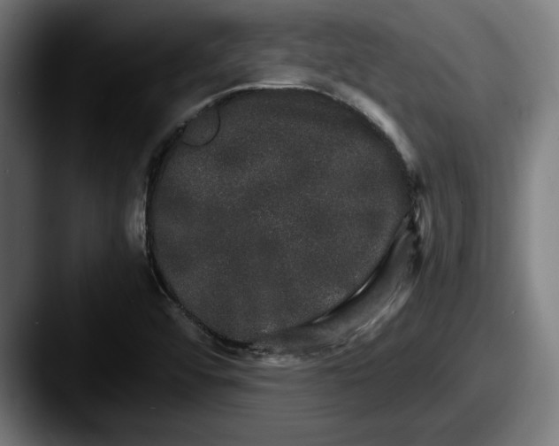 X0000087521456200705181003