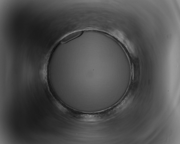 X0000087521500200705181003