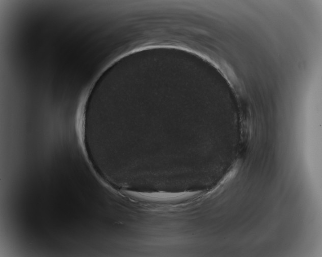 X0000087521519200705181003