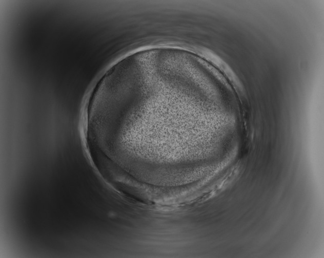 X0000087521520200705181003