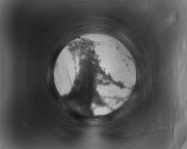 X0000087520169200705251646