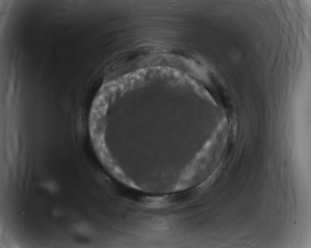 X0000087520170200705251646